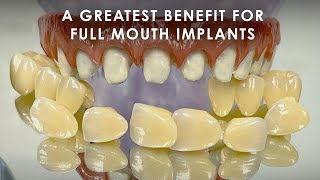 A Great Benefit for Full Mouth Implants