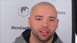 Georg's Life changing transformation with scalp micropigmentation | Clinique MicroCapillaire