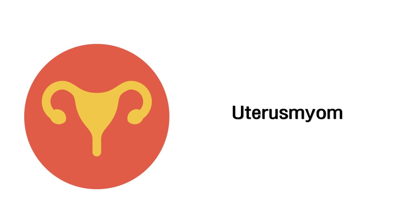 Uterusmyom - Erkrankungen Der Geschlechtsorgane (mit Infoleiste) - YouTube