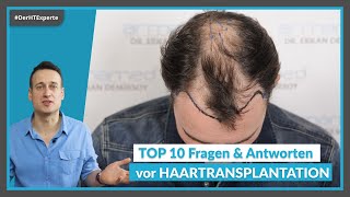 10 Dinge, die du VOR deiner Haartransplantation beachten musst