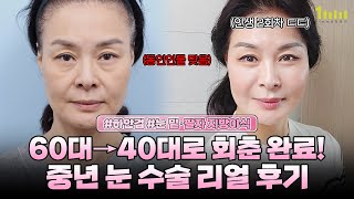 중년 눈 성형 후 60대에서 40대로 회춘 완료! [1mm성형외과]｜ [일미리성형외과]