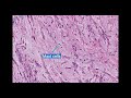 pathology case 186