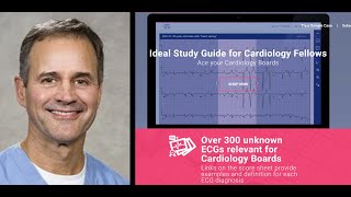 O'Keefe ECG Cardiology Board Prep 2023 - Session 2