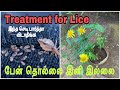 How to treat Lice naturally?/பேன் தொல்லையா இனி கவலையே இல்லை!?/Herbal treatment for lice/Dysentery