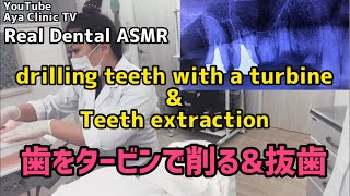 Real Dental ASMR \