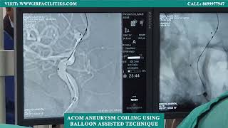 ACOM Aneurysm Coiling Using Balloon-Assisted Technique | IRFACILITIES