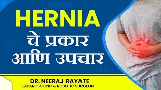 Hernia (हर्निया) चे प्रकार आणि उपचार | Dr. Neeraj Rayate