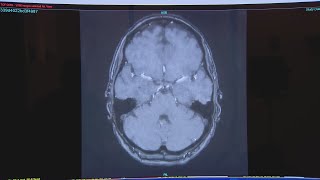 New head to toe MRI to spot earliest signs of diseases