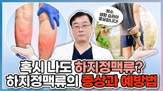 혹시 나도 하지정맥류? 하지정맥류의 증상과 예방법｜겉으로 드러나지 않는데 하지정맥류가 있을 수 있다고요? 😲