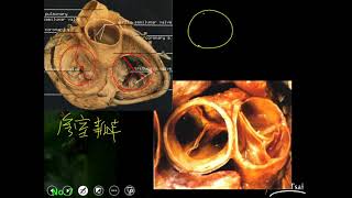 10801高三選修生物ch05 2 02人體心臟的瓣膜二禮