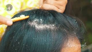 She scratch dandruff look so interested 2122