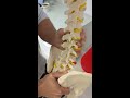 movement of facet joints in lumbar spine on flexion and extension