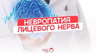 Парализовало лицо | Невропатия лицевого нерва