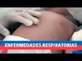 Recomendaciones y cuidados para Enfermedades Respiratorias en niños.