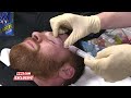 sami zayn gets fluid drained from eye after clash with braun strowman raw exclusive dec. 26 2016