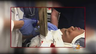 Maryland Boy Survives After Tip Of Screw Lodged In His Skull