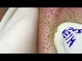 Satisfying Hien Spa Beauty Relaxing Video #11