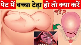 पेट में बच्चा टेढ़ा हो तो क्या करें  - Transverse Baby in womb in Hindi - Youtube mom