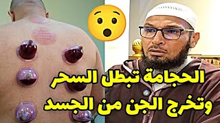 هل الحجامة تبطل السحر والعين والحسد وتخرج الجن من الجسد ؟ الشيخ طاهر ضروي حفظه الله #الشيخ_طاهر_ضروي