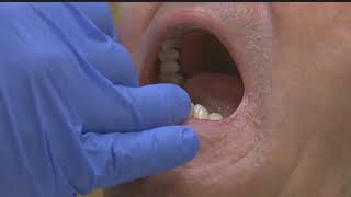 Whitening strips could be harmful to your teeth