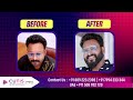 hair transplantation കഴിഞ്ഞപ്പോൾ ഞങ്ങളേക്കാൾ young ആയെന്നാ പപ്പയുടെ വിചാരം cutis international