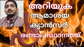 ആമാശ കാൻസർ രണ്ടാം സ്ഥാനത്ത് /ലക്ഷണങ്ങളും കാരണങ്ങളും /