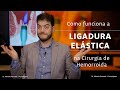 Como Funciona a Ligadura Elástica na Cirurgia de Hemorroida