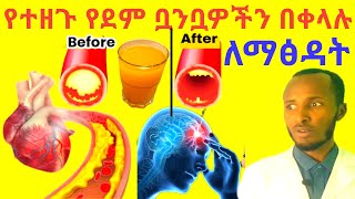 የተዘጉ የደም ቧንቧዎችን በቀላሉ ለማጽዳት Unclog Blood Vessels Naturally