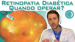 Retinopatia diabética, quando operar? Cirurgia de vitrectomia.