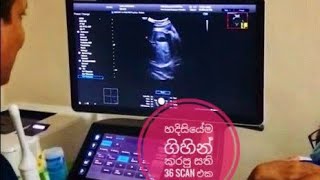 හදිසියේම ගිහින් කරපු සති 36 Scan එක | 36 Week Pregnant ultrasound |Dr.Probhodana Ranaweera