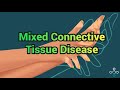 Mixed Connective Tissue Disease - CRASH! Medical Review Series