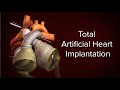 Medical Animation: Total Artificial Heart Implantation | Cincinnati Children's