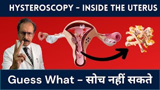 Hysteroscopy in Infertility | Bones of Baby |Dr. Sunil Jindal|