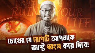 চোখের যে রোগটি আপনাকে ধ্বংস করে দিবে | Saleh Ahmed Toha