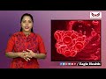 prevent clotting of blood బ్లడ్‌ క్లాట్స్‌ ఏర్పడకుండా ఉండాలంటే వీటిని తీసుకోవాలి blood clotting