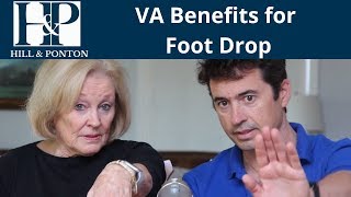 Getting VA Benefits for Foot Drop | Are You Getting Your Highest Rating?