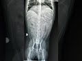 Radiographic evaluation - abdominal (normal vs abnormal)