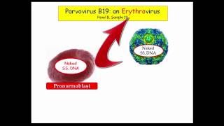 12DaysinMarch, Parvovirus B19 for USMLE Step One