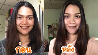 ยืดเคราติน vs ยืดถาวร | อะไรดีกว่ากัน ? ราคาเท่าไหร่ ?