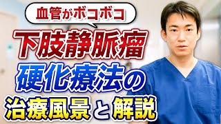 足の血管がボコボコ 下肢静脈瘤の硬化療法の治療風景と解説