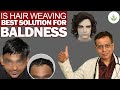 Hair Weaving Best Solution for Baldness? Get Answer Here! | Care Well Medical Centre