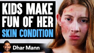Kids MAKE FUN Of Girl's SKIN CONDITION, What Happens Is Shocking | Dhar Mann