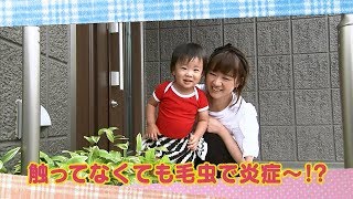 【公式】「触ってなくても毛虫で炎症～!?」（8月20日放送）｜テレビ西日本