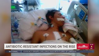 Antibiotic-resistant infections on the rise in U.S.