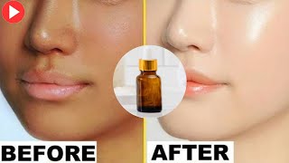 You'll Never Believe This Kojic Acid Benefits for Lightening Skin \u0026 More Fact