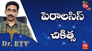 Paralysis - Treatment |పెరాలసిస్ - చికిత్స | Dr.ETV | 30th April 2022 | ETV Life