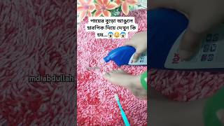 পায়ের বুড়ো আঙুলে হারপিক দিয়ে দেখুন কি ঘটে😱 #music #foryou #shorts #Harppk hack #harppic  #newhack