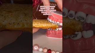 Are you WORRIED about BRACES PAIN? *what to do #braces #orthodontist #pain