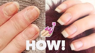 HOW I FIXED MY DAMAGED NAILS