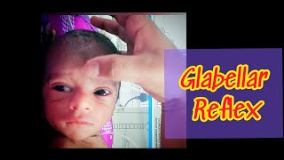 Glabellar Reflex.